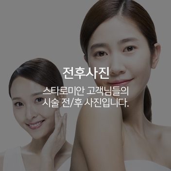 전후사진